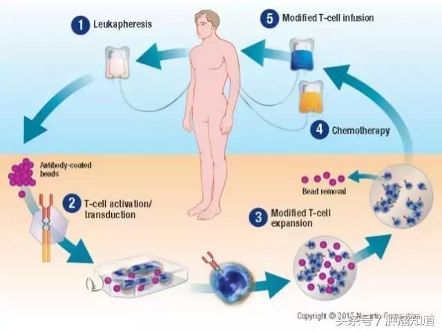 car-t最新治愈进展,三分钟深度了解cart疗法
