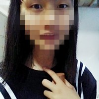 双眼皮松弛全切恢复过程,全切双眼皮几天能够洗脸