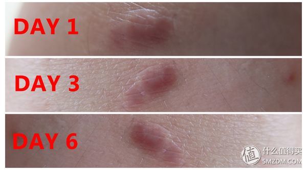 家庭医护小药箱,家庭用的医疗急救药箱