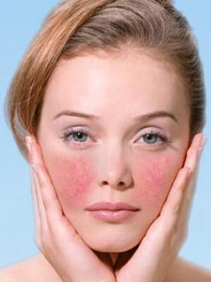 使用什么洗面奶才不会刺激角质层,用什么洗面奶不伤角质层的