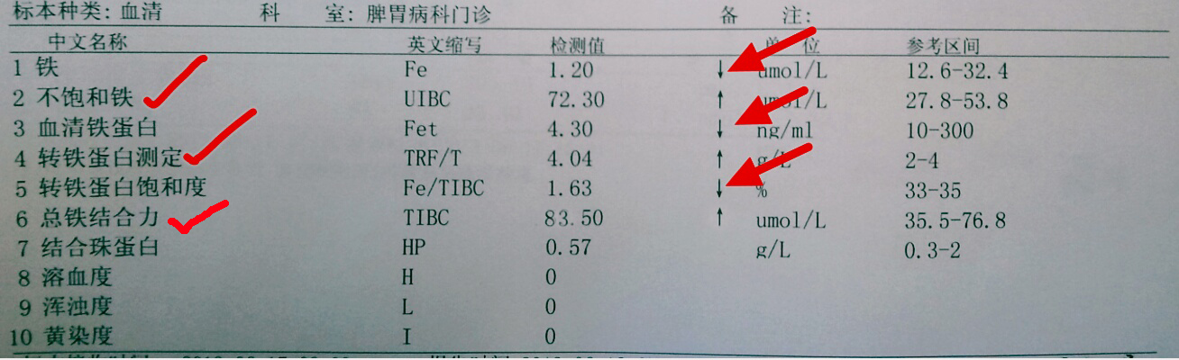 血常规报告单数据能够看出贫血,地中海贫血的血常规报告单怎么看