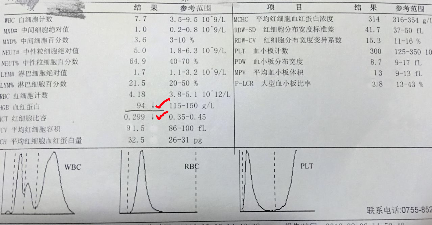 血常规报告单数据能够看出贫血,地中海贫血的血常规报告单怎么看
