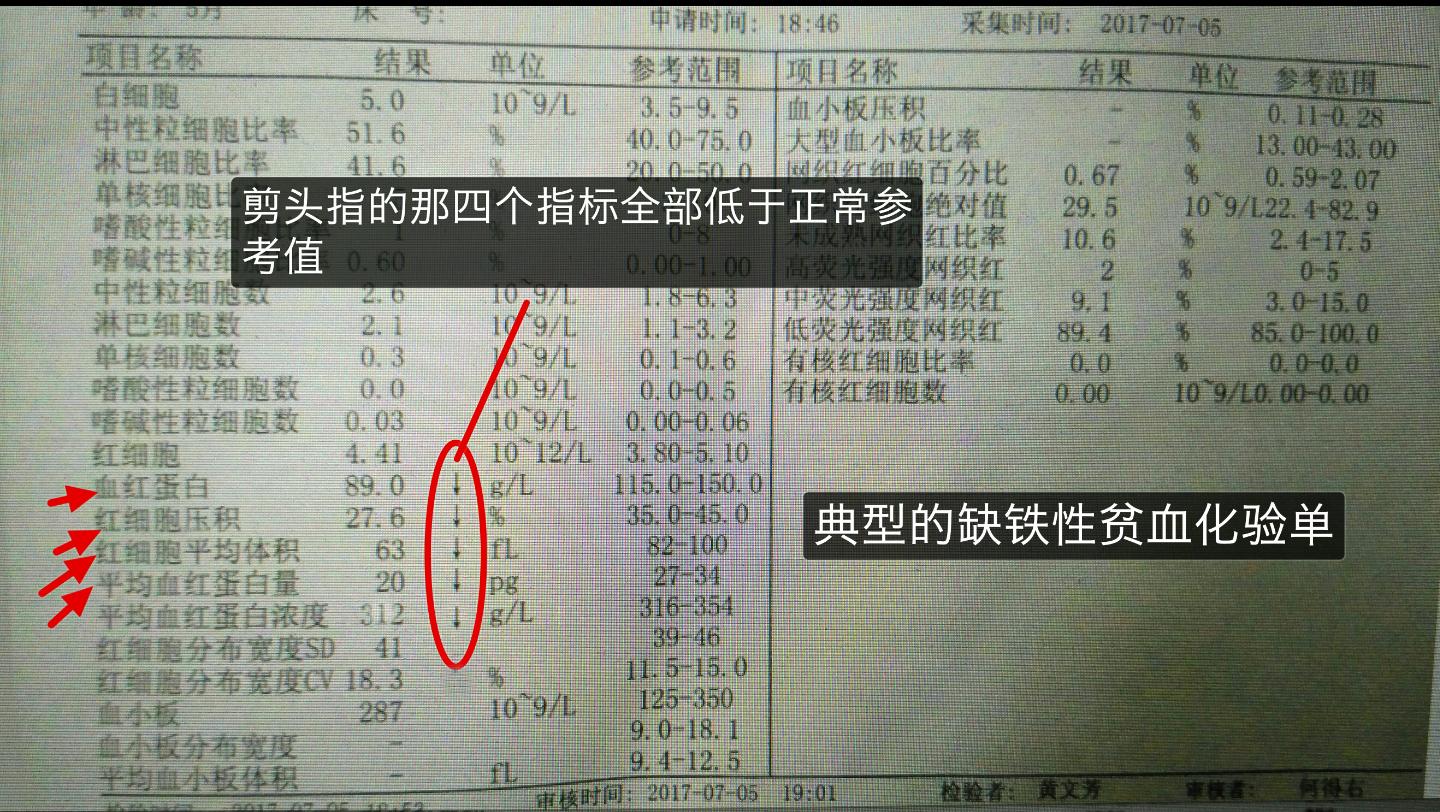 血常规报告单数据能够看出贫血,地中海贫血的血常规报告单怎么看