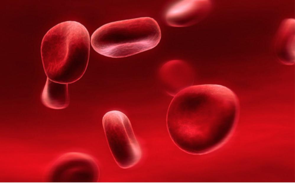 血常规报告单数据能够看出贫血,地中海贫血的血常规报告单怎么看