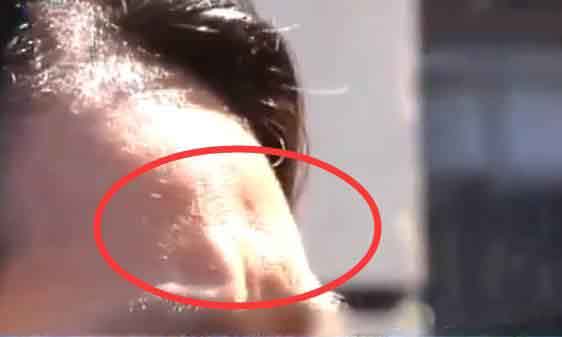 为什么超声做的结果不一样呢,超声刀效果是什么