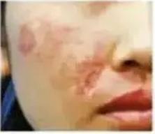 为什么超声做的结果不一样呢,超声刀效果是什么