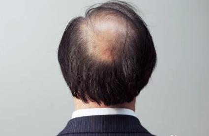 千错万错都是自己的错，亲手毁了自己的头发！