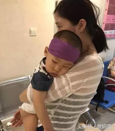 2岁宝宝摔跤手指破皮出血,小孩子摔跤出血去医院缝针