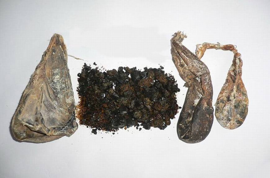 某女卧病在床久治不愈，赤脚医生竟扬言要用*胆熊**还魂！