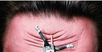 祛抬头纹小秘方,冻龄去皱纹最快的方法