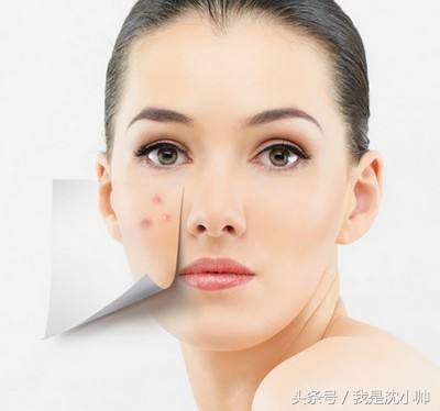 如何祛痘痘印的小窍门简单有效,如何快速祛痘祛痘印小妙招