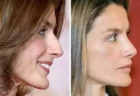 名流｜她如何从洛丽塔变身西班牙王后？