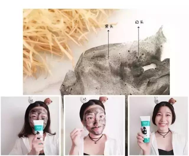 去黑头小妙招你的黑头有救了,别挤了教你去黑头的正确方法