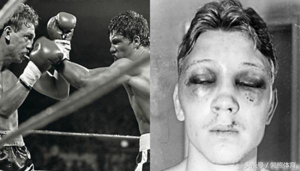 为什么拳击比赛戴拳套,拳击比赛戴着拳套还会重伤对手吗