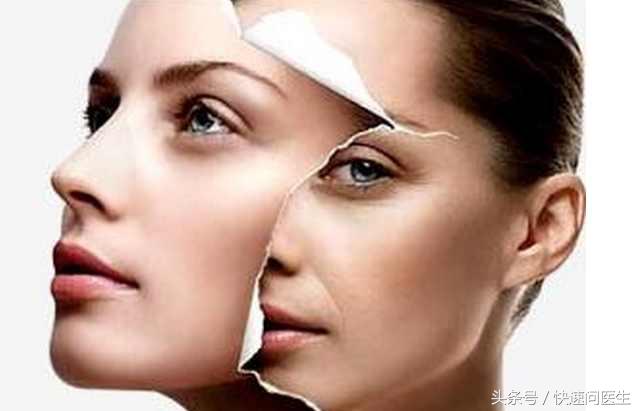 色素冷静淡斑内调方法,色素色斑怎么祛除最有效