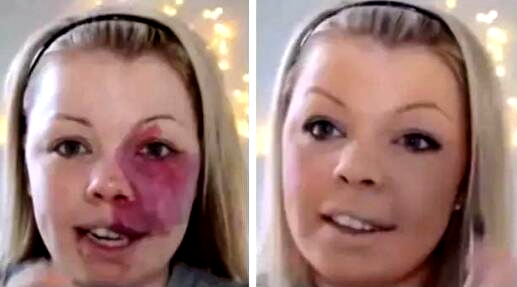 鑴镐笂鏈夎儙璁扮殑濂冲鍖栧褰╃粯,缁欎竴涓弧鑴歌儙璁扮殑濂冲鍖栧