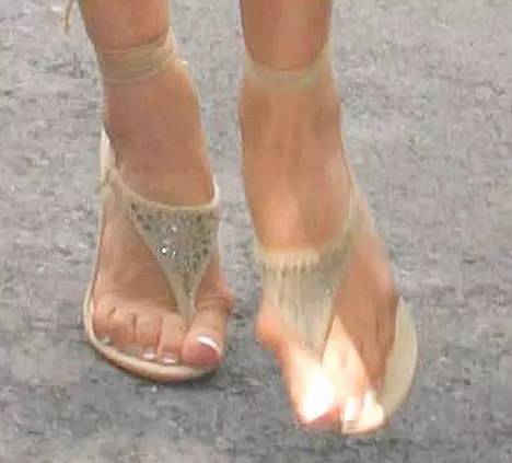 姑娘们，别让高跟鞋毁了你的双脚