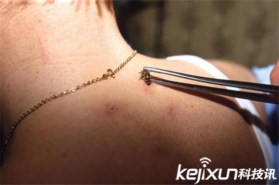 奇葩式养生,奇葩养生系列视频