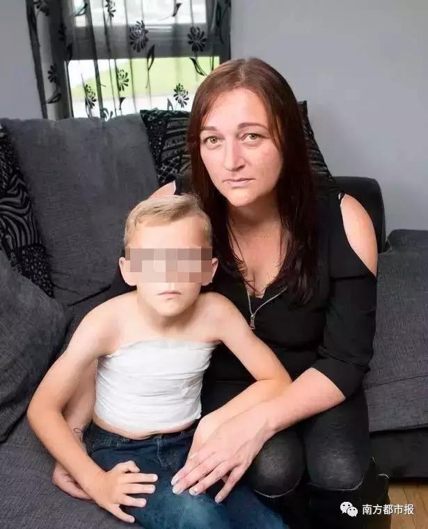 女子洗纹身后破溃化脓了,纹身烫伤起泡会留疤吗