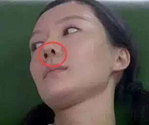 与山西首富离婚，母亲国家一级演员，整容过度今无人敢娶无戏可演