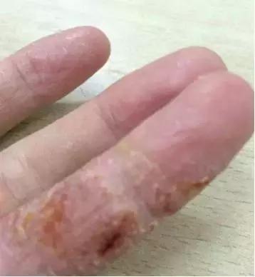 农村的哪些野菜能有中药功效,农村有什么野菜治病