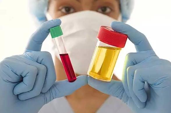 就医搜｜每10人中就有1人中招！高尿酸血症真的与你无关？