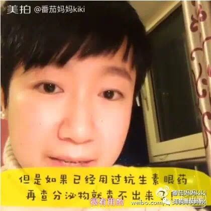 宝宝眼睛黄色眼屎导致眼睛发红,宝宝眼睛眼屎多黄稠怎么解决