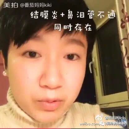 宝宝眼睛黄色眼屎导致眼睛发红,宝宝眼睛眼屎多黄稠怎么解决