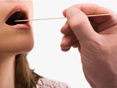 咽炎喉咙痒咳嗽的症状,嗓子干痒咳嗽是咽炎吗吃什么药