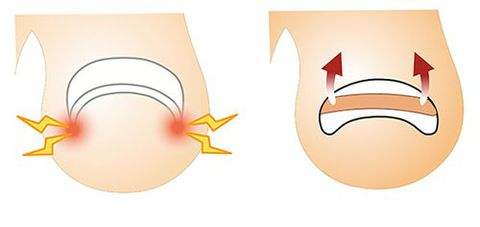 指甲往肉里长该怎么办？一定要试试这几招！