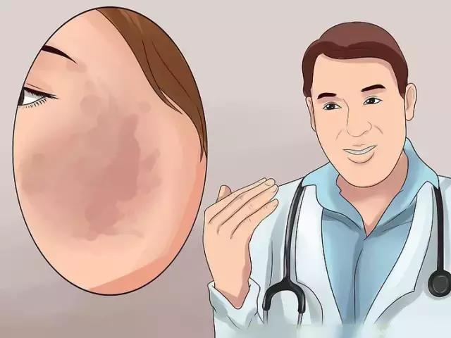 脸上有黑点怎么消除视频,脸上出现小黑点如何去除