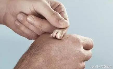 手指被鱼刺扎了要多久能好,指甲扎进鱼刺用打破伤风吗