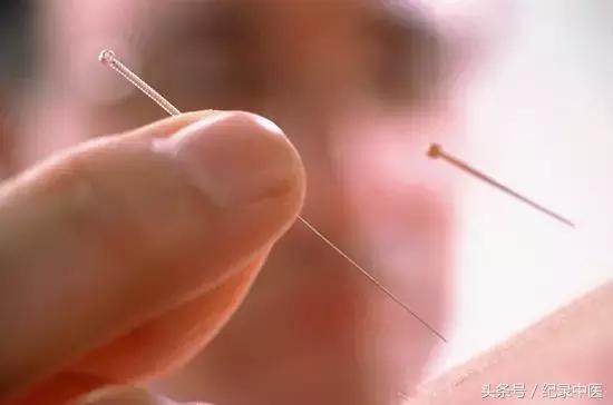 中医在国外开店,美国中医金鸣