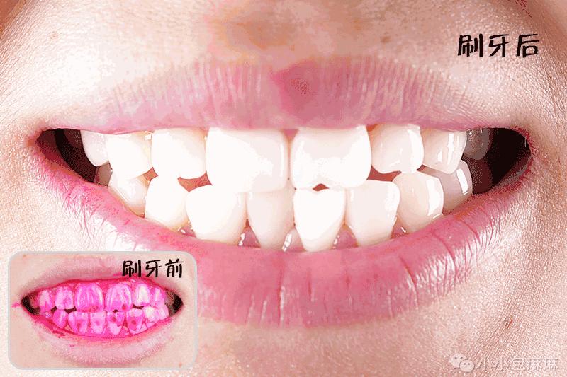 儿童牙膏3-12岁儿童专用不要辣的,儿童牙膏13岁以上推荐