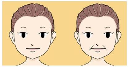 自体脂肪填充法令纹,已经开始出现法令纹了怎么办