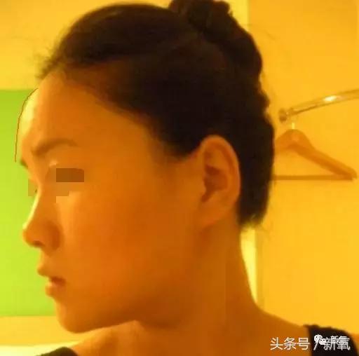 杨紫瘦了腿显得不纤细,杨紫变美之路脸怎么瘦的