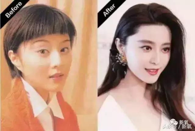 杨紫瘦了腿显得不纤细,杨紫变美之路脸怎么瘦的