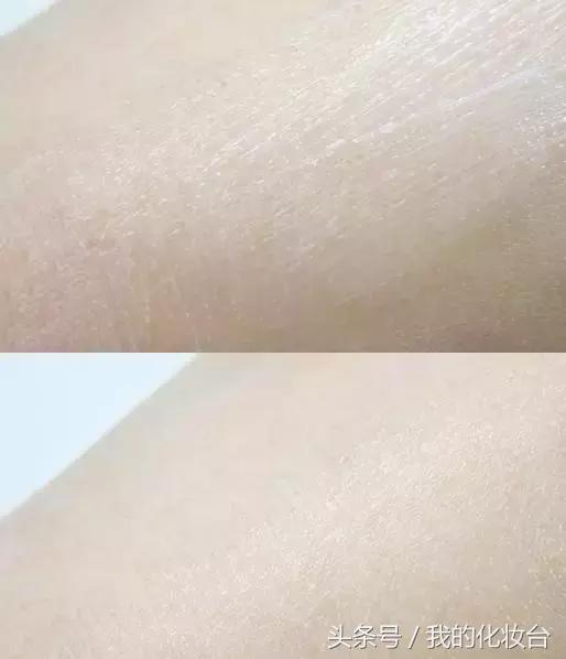 去天生颈纹的方法,颈纹多怎么锻炼