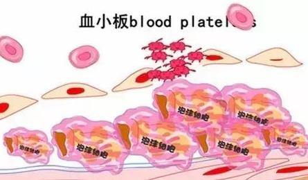 血小板数值忽高忽低是怎么回事,血小板忽高忽低什么原因