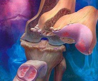 治膝骨关节炎国内最好的医院排名,骨关节前十医院