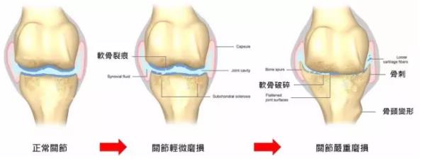 治膝骨关节炎国内最好的医院排名,骨关节前十医院
