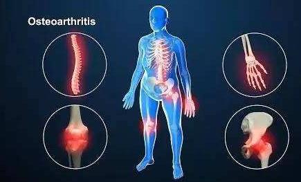 治膝骨关节炎国内最好的医院排名,骨关节前十医院