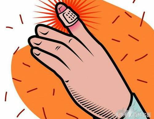 被划破了点皮会不会得破伤风,皮肤被划破没出血会得破伤风么