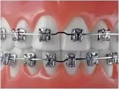 俗话说牙缝大会漏财,两边牙缝大漏财还是进财