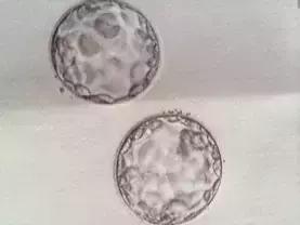 太神奇！生殖医学博士揭秘试管婴儿全过程！