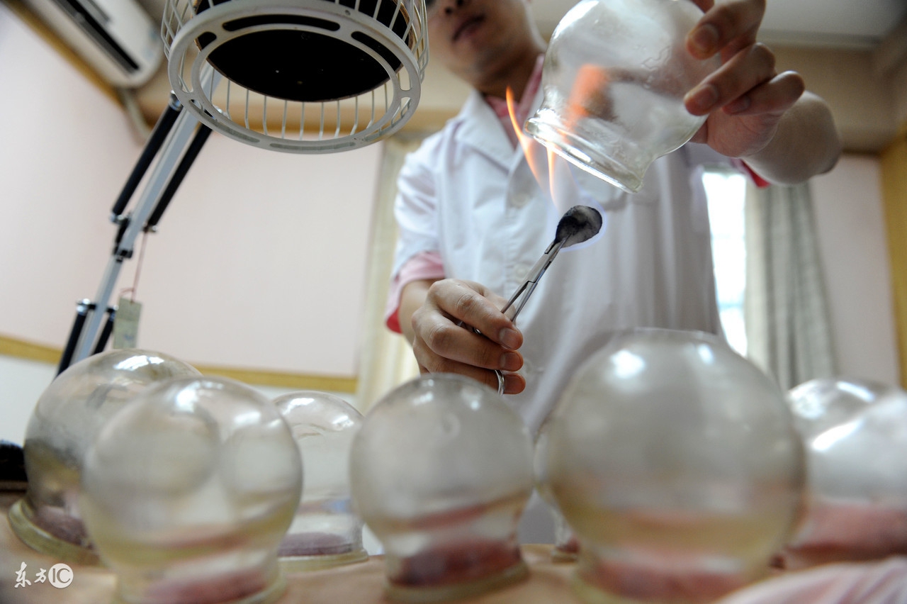 体内湿气大拔罐还是刮痧,拔罐祛除体内湿气位置图