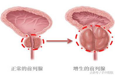 男人到了30岁还有病吗,男人得了这三种病