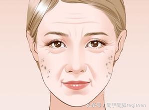 吃三七粉斑反而重了,吃多长时间三七粉斑能够淡化掉