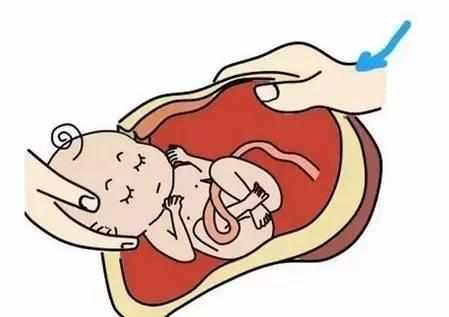 剖腹产麻醉对身体副功能,剖腹产麻醉对身体的危害