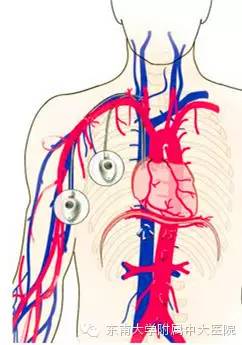 北大血管介入外科,北京大学第一医院介入血管外科